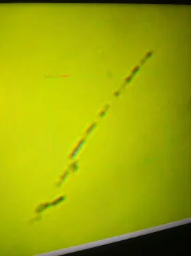 40x-800x Amscope In300tb Long Distance Plan Optical Biological Inverted Microscope #2