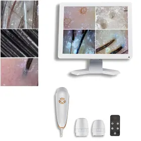 Ps-11v3 Mychway 15.6 Inch Screen Scalp Hair Face Skin Detector Analyser Machine Digital
