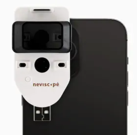 Triseven 684417807492 Neviscope Black Phone Dermatoscope Microscope With Polarized Lens/led Light