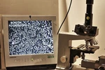 Leitz Enderlein Live Blood Video Microscope With Oil Darkfield And Color Camera. Fixed Price $3999.00.